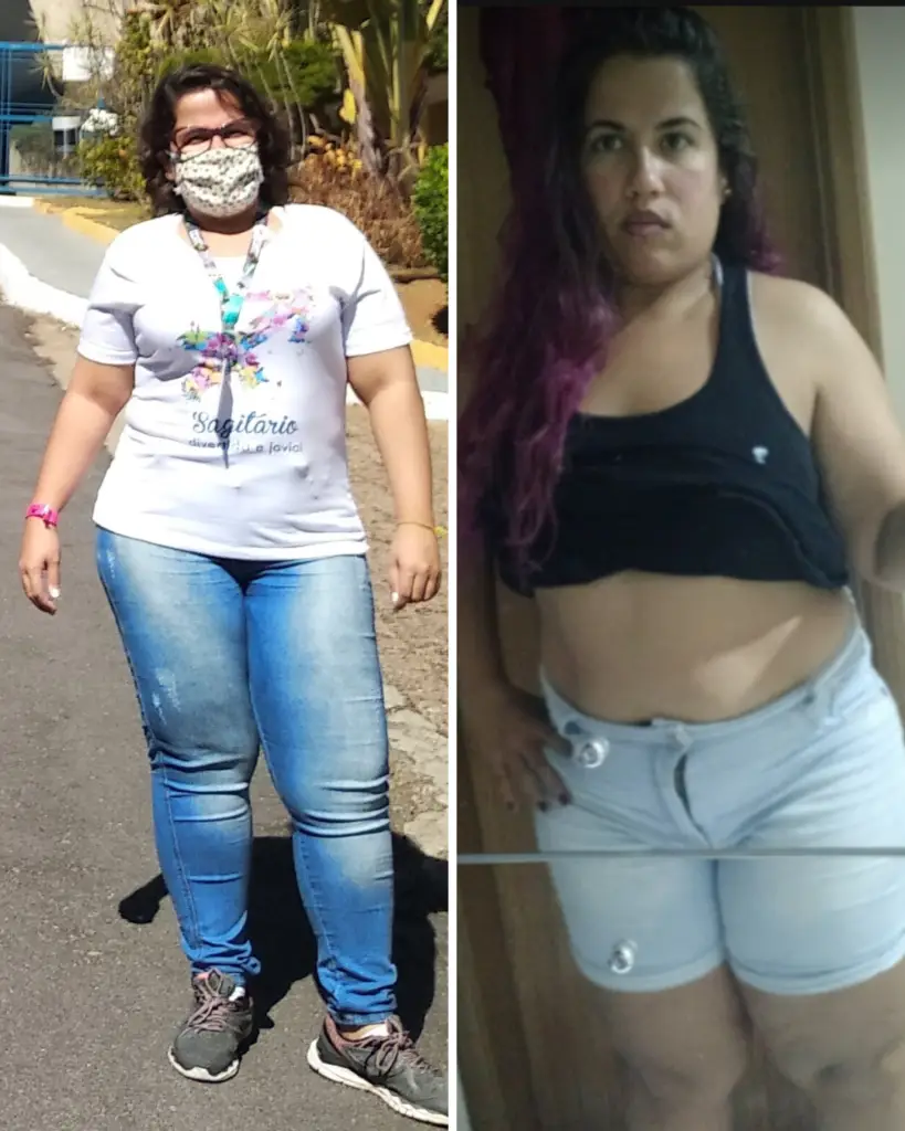 Antes e Depois Natasha Florencio